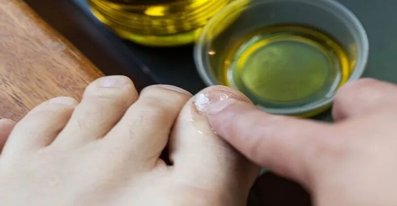 Essential oils to fight against fungi